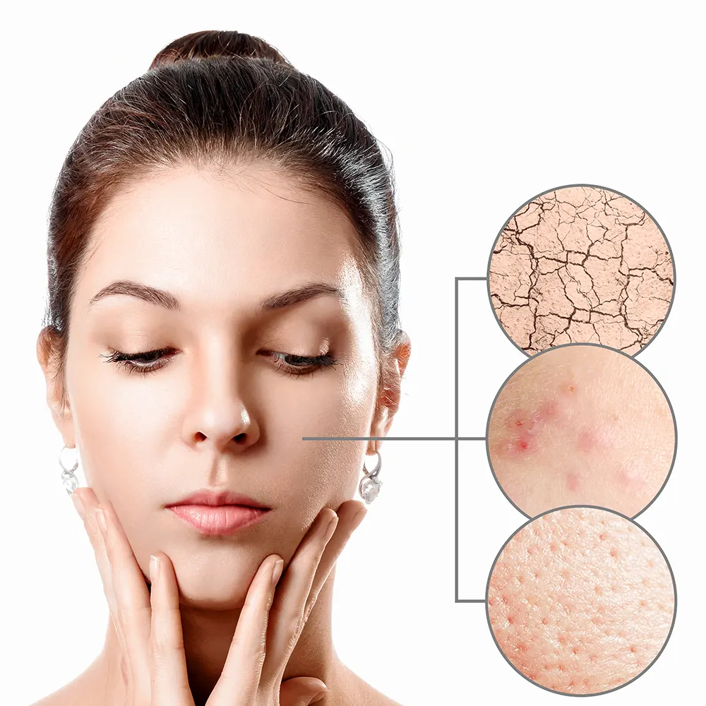 dermatoloji-avicena-hastanesi