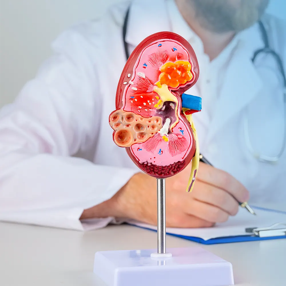 uroloji-avicenna-hastanesi